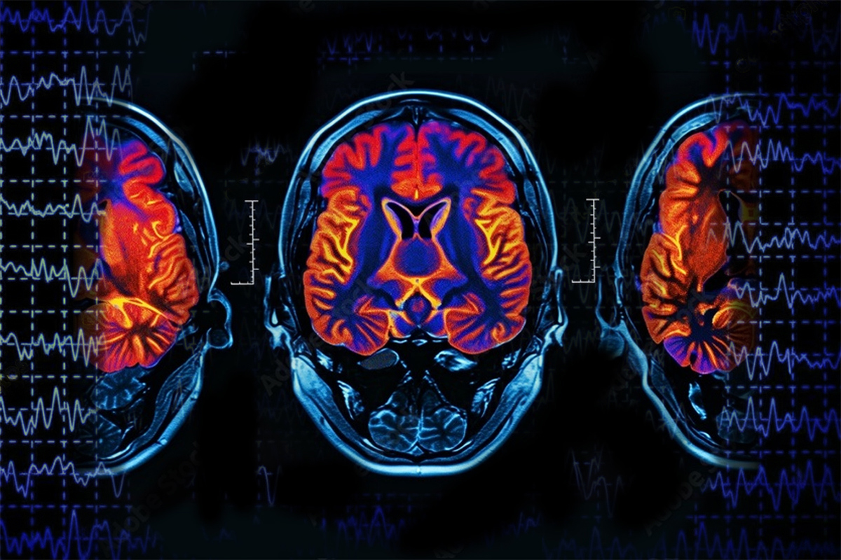 Innovations in Neuroimaging Methods