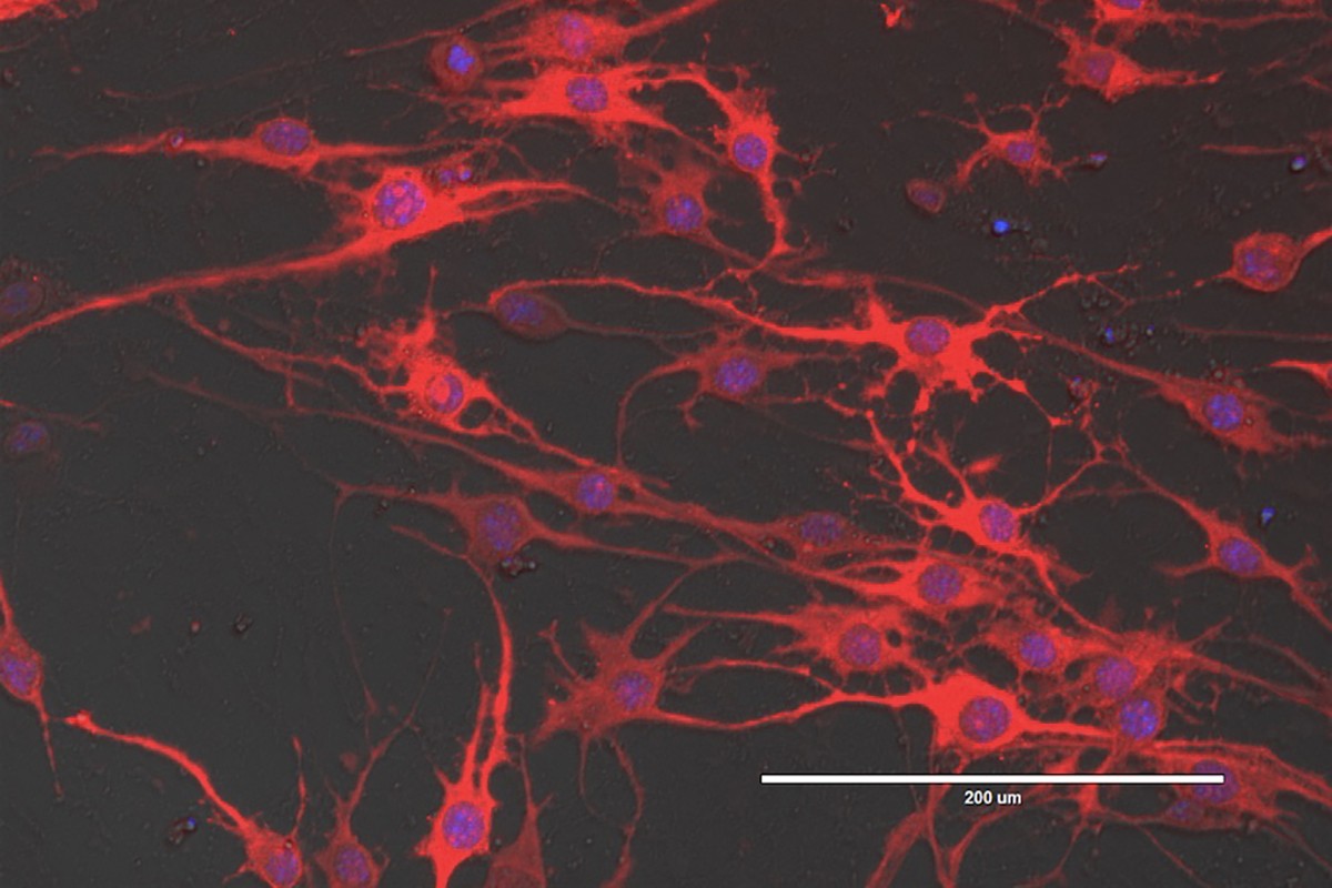 Neuronal cells induced from mouse embryonic fibroblasts.