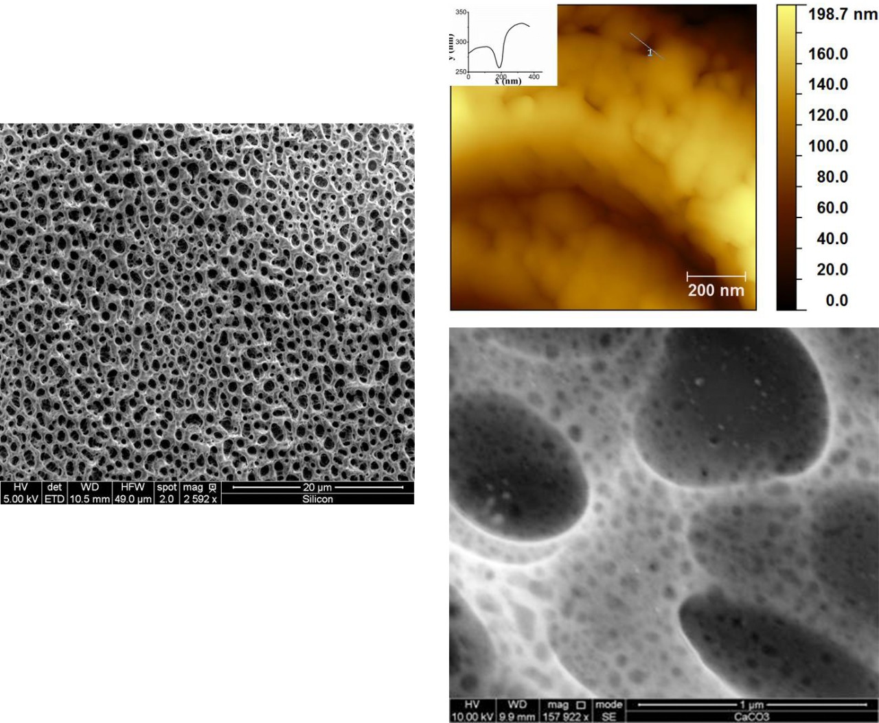 Micro- and nanopores of calcium carbonate scaffolds.