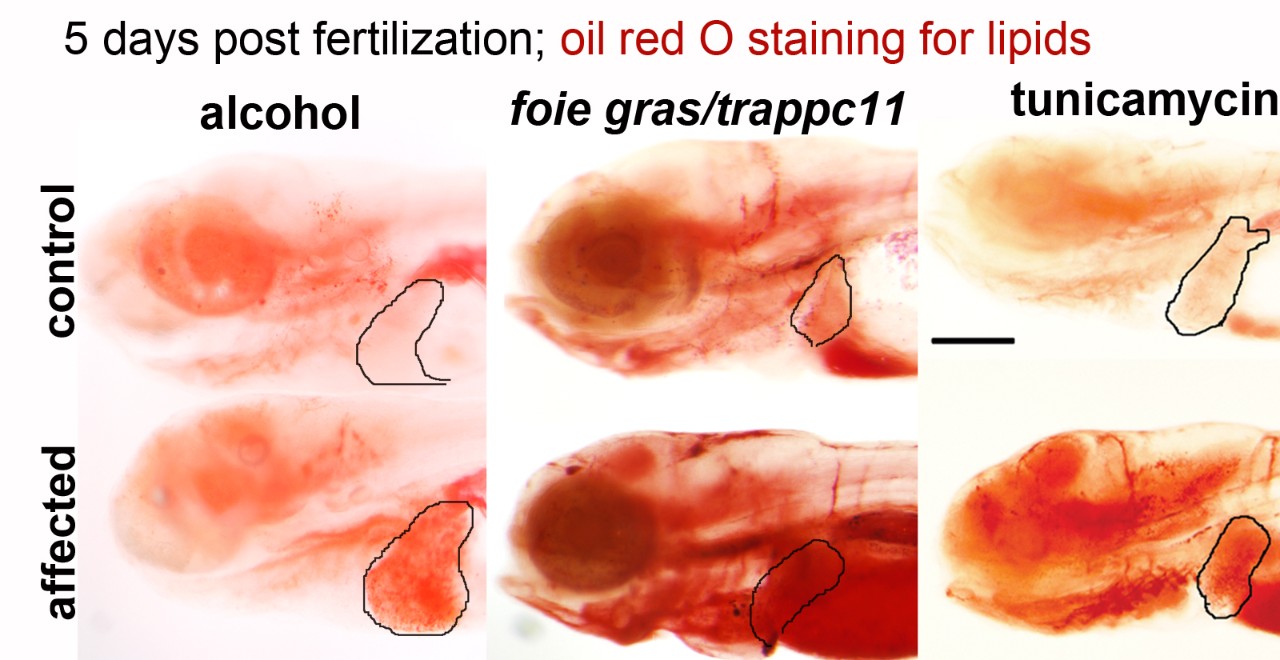 Five days post fertilization; oil red O staining for lipids.