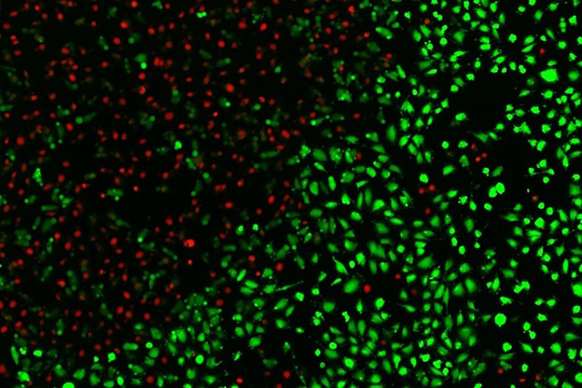 Cell Surgery Without the Incision - NYU Abu Dhabi